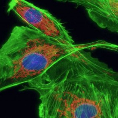 熒光濾光片對熒光成像系統(tǒng)的影響