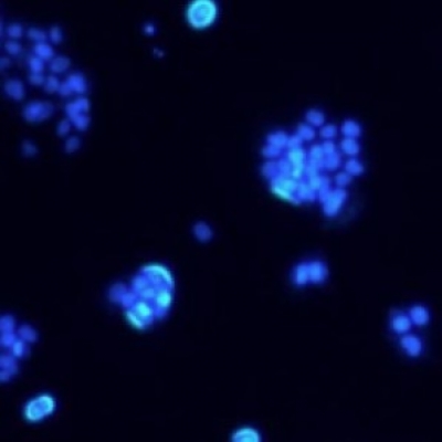 熒光成像使用的不同類型熒光濾光片的作用